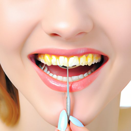 VII. Prevention and Treatment of a Yellow Roof of Mouth