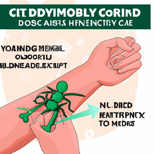 Why CBD Is a Promising Treatment for Muscle Knots: A Comprehensive Guide