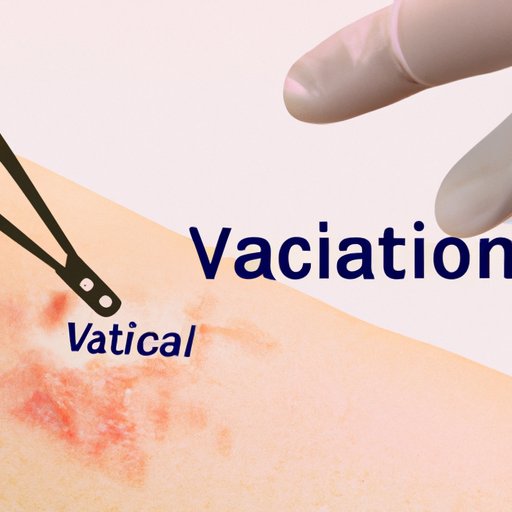 V. Cauterization for Skin Tag Removal