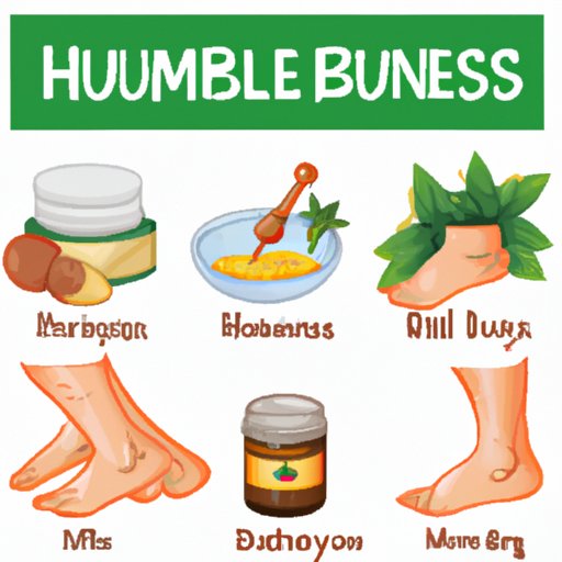  Home remedies to heal bruises naturally 