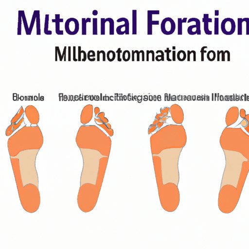 Exploring the Clinical Manifestations of Morton Neuroma in Foot Health