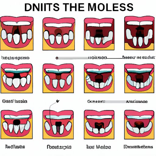 The Different Kinds of Molars and Their Functions in Your Mouth