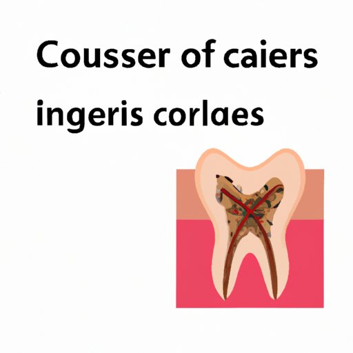 IV. Exploring the Triggers: What Causes Canker Sores and Why They Hurt