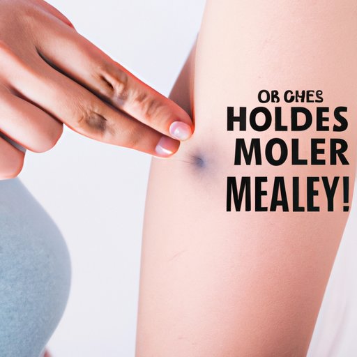 Common Mistakes People Make When Dealing with Hairy Moles