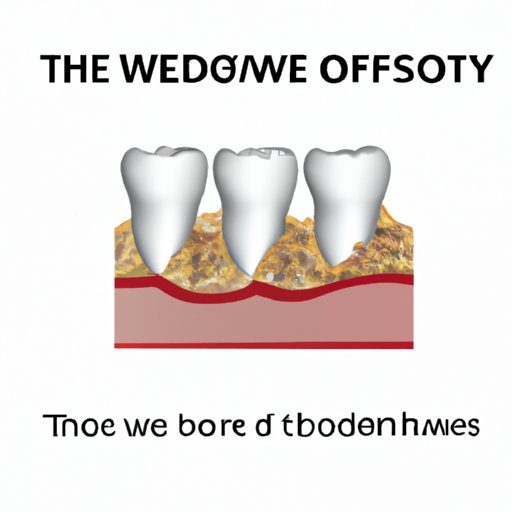 The Science Behind Wisdom Teeth Removal: Understanding the Anatomy and Physiology of Extra Molars