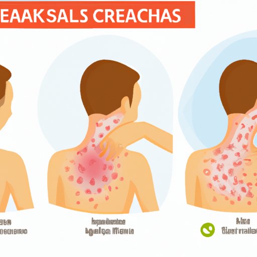 From Eczema to Psoriasis: Understanding Skin Conditions that Can Lead to an Itchy Neck