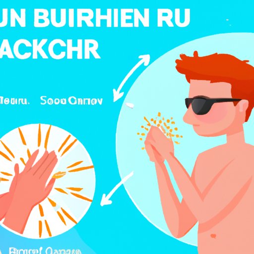 Breaking the Cycle of Sunburn Itch: How to Prevent Scratching and Promote Healing