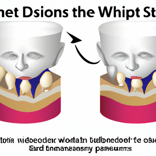 II. Understanding the Science Behind Asymmetrical Swelling After Wisdom Teeth Extraction