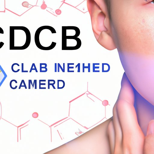 Does CBD Help With Cystic Acne? A Comprehensive Guide