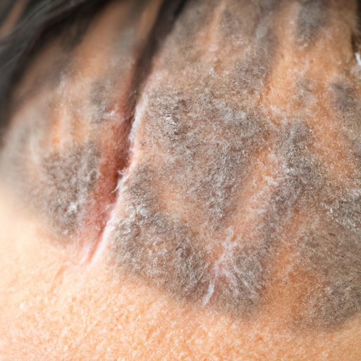 How to Get Rid of Hair Bumps on Private Area: The Ultimate Guide