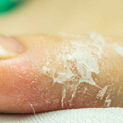 Why Are My Feet Peeling All of a Sudden? Causes, Remedies, and Prevention Tips