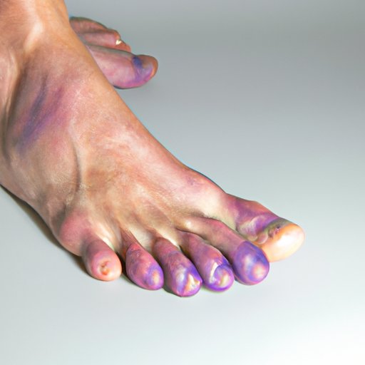 Why Are My Feet Purple? Exploring the Potential Causes and Solutions