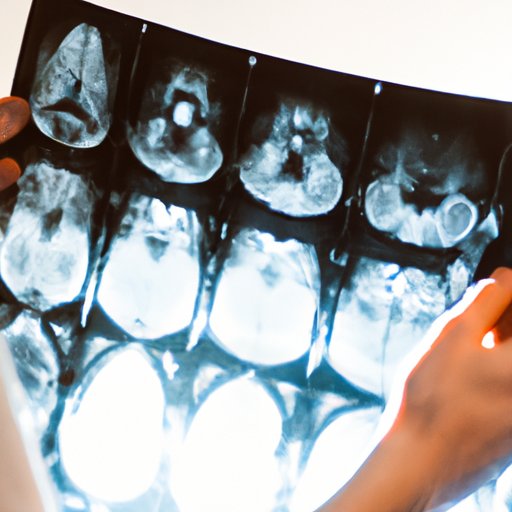 How to Become a Radiologist: A Step-by-Step Guide to Pursuing a Rewarding Medical Career