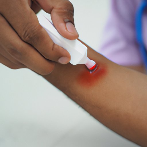 A Complete Guide to Checking for Pinworms: Symptoms, Prevention, and Treatment