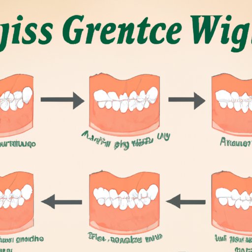How to Cure Gingivitis in a Week: Best Practices and Step-by-Step Guide