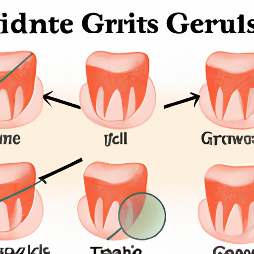 How to Cure Gingivitis: A Comprehensive Guide to Healthy Gums