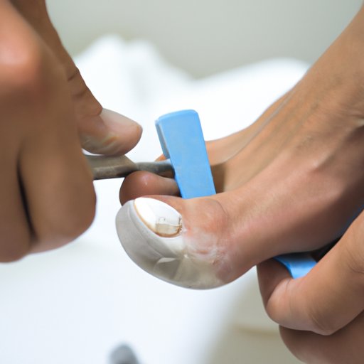 How to Fix Hammertoe: A Comprehensive Guide to Treatment and Prevention