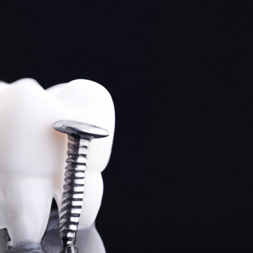 How to Get Dental Implants Covered by Insurance: Tips and Personal Success Stories