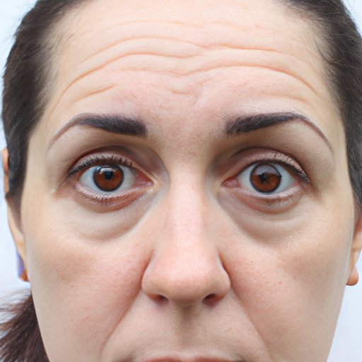 10 Natural and Effective Ways to Get Rid of Bags Under Your Eyes | DIY Remedies, Lifestyle Changes, and Medical Interventions