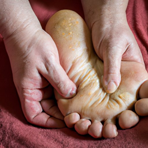 How to Get Rid of Calluses on Feet – 8 Effective Methods