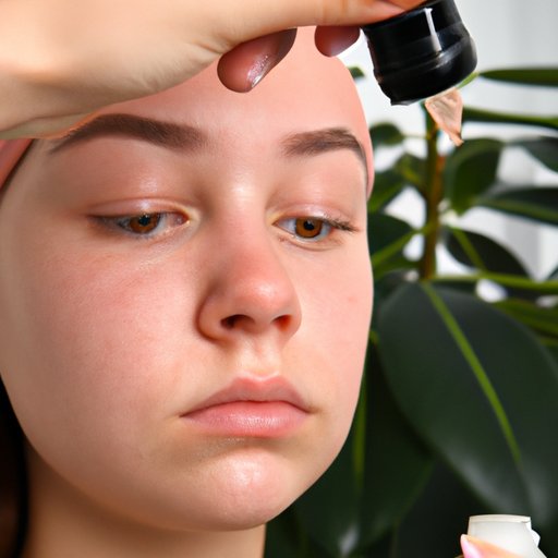 Say Goodbye to Pimples: A Holistic Approach to Clear Skin