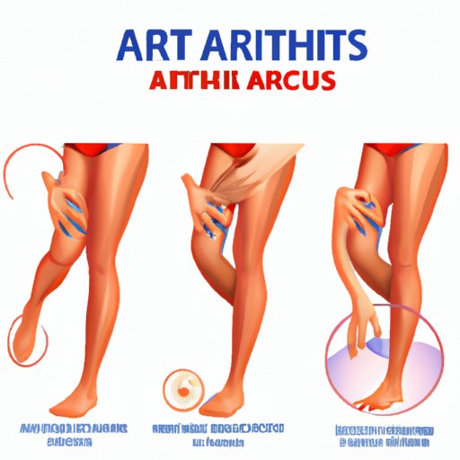 How to Prevent Arthritis: Diet, Exercise, and Lifestyle Tips