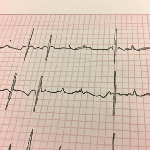 The Beginner’s Guide to Reading an EKG: Everything You Need to Know