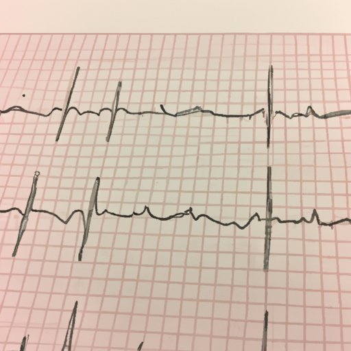 The Beginner’s Guide to Reading an EKG: Everything You Need to Know