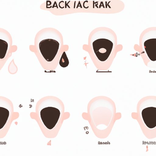 How to Remove Blackheads: DIY, Exfoliation, and Other Helpful Tips