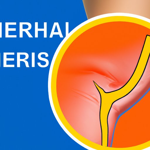 How to Tell If You Have a Hernia: Recognizing Symptoms and Seeking Treatment