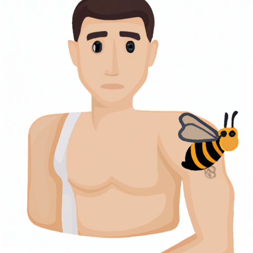 Bee Sting Treatment: Identifying Symptoms and Proper Removal