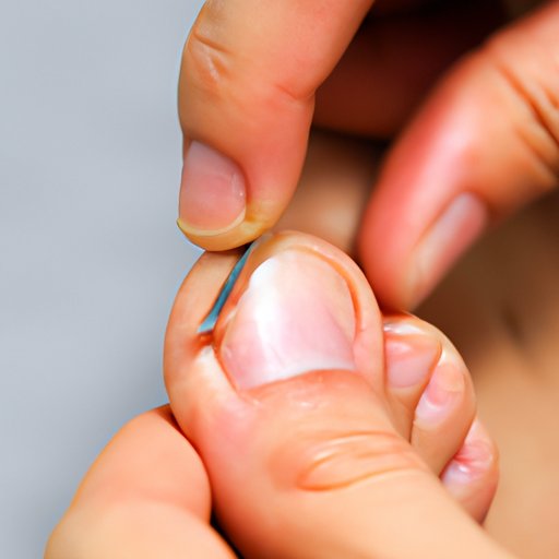 Ingrown Toenail: Tips and Information on Treating and Preventing