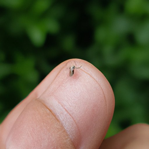 How to Treat Spider Bites: Natural Remedies and Medical Treatment