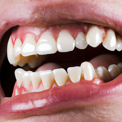 How to Whiten Teeth Naturally, Safely and Effectively: A Comprehensive Guide