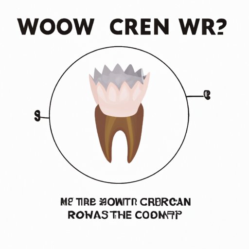 A Guide to Understanding Dental Crowns: Everything You Need to Know