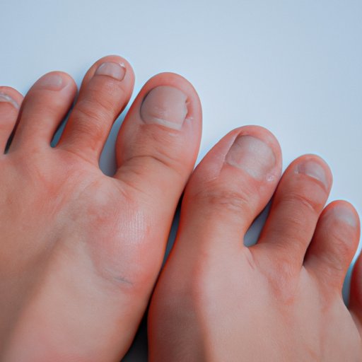 Understanding Plantar Warts: Causes, Symptoms, and Treatments