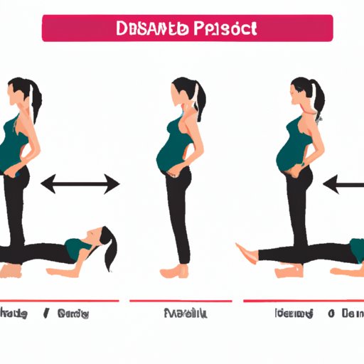 The Beginner’s Guide to Diastasis Recti: Preventing, Identifying, and Treating Abdominal Separation in Women