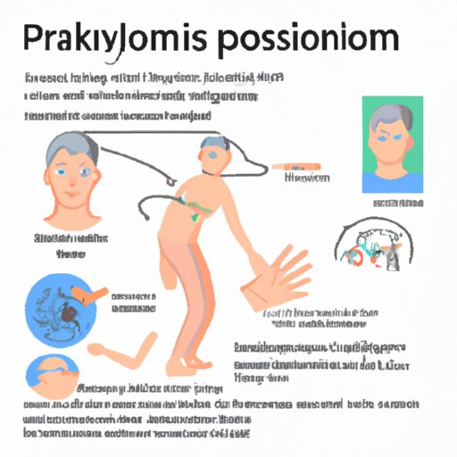 Parkinsonism: Understanding and Coping with Symptoms