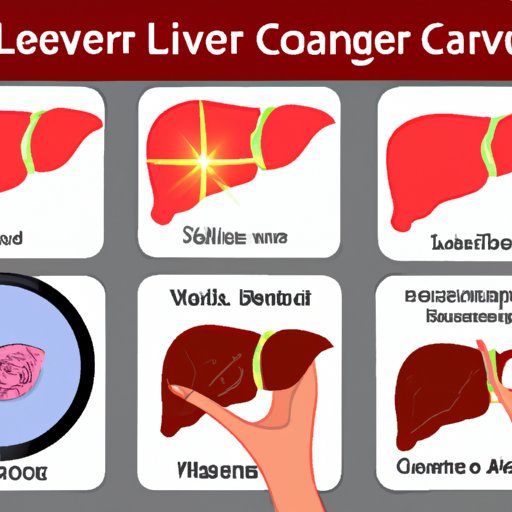 The First Sign of Liver Cancer: Understanding Early Detection