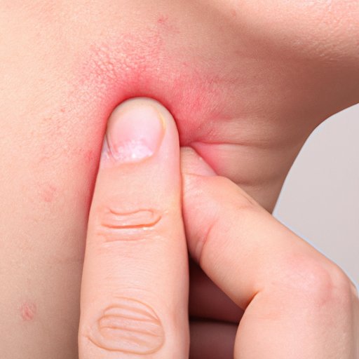 The Importance of Understanding Fissures and How to Treat Them