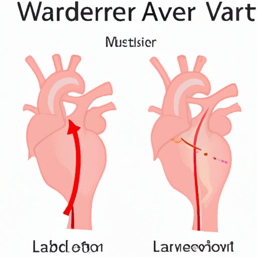 The Widow Maker Artery: Functions, Symptoms, Prevention and Treatment