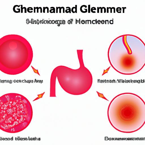 Glandular Inflammation: Understanding Symptoms, Causes, and Treatments