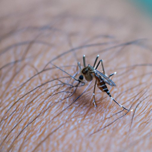 Why Are Mosquito Bites Itchy? Exploring the Science and Solutions for Mosquito Infested Areas