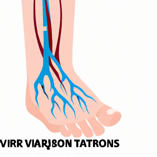 Why Are My Feet Veins Popping Out? Understanding the Causes and Solutions
