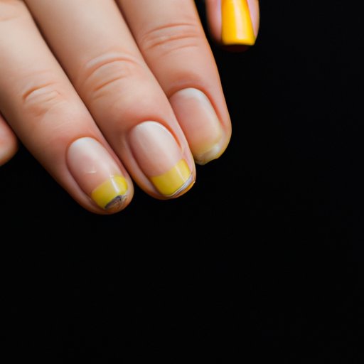 Why Are My Nails Yellow at the Tips? Understanding the Causes, Diagnosis, and Home Remedies