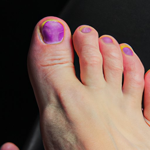 Why Are My Toes Purple? Understanding Causes, Treatments, and Prevention Strategies