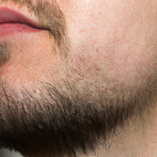 The Beard Struggle: Understanding Why You Can’t Grow A Beard
