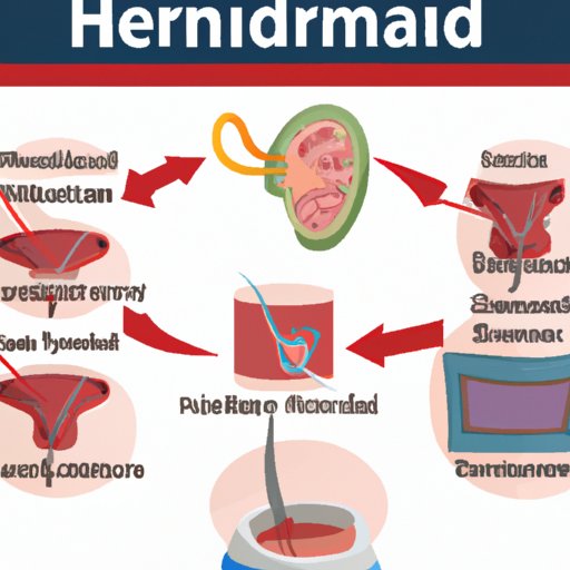 Why Banding External Hemorrhoids Is Not Recommended: Exploring Alternative Treatment Options