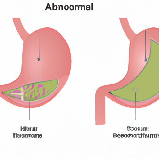 Why Do I have a Line on My Stomach? Understanding the Science and Solutions