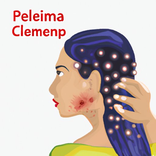 What Are Scalp Pimples? Causes, Treatment, and Prevention Guide